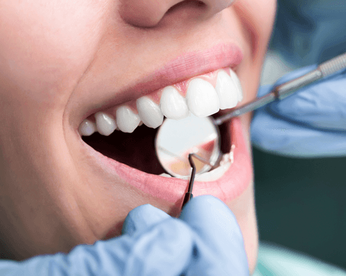 traitement orthodontique Montréal