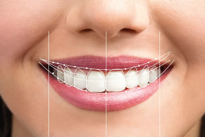 reconstruction esthétique Plateau-Mont-Royal