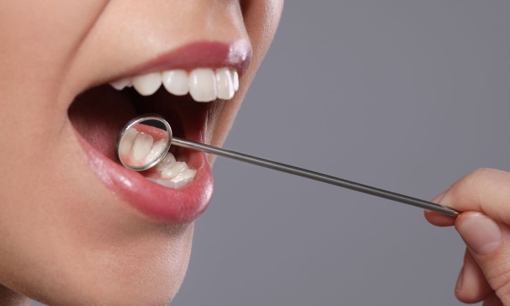 suivi parodontale Montréal 1